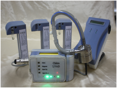 Paracorporeal Left Ventricular Assist Device